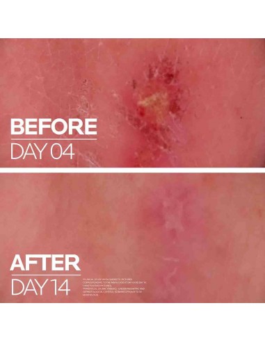 LA ROCHE CICAPLAST BAUME B5+ 40ml