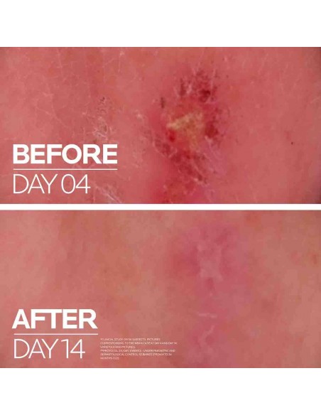 LA ROCHE CICAPLAST BAUME B5+ 40ml